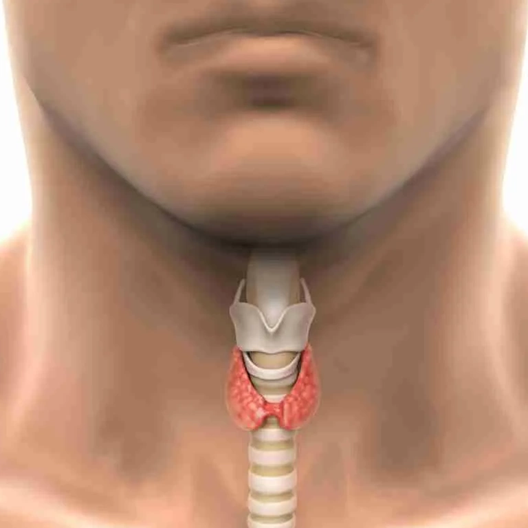 Кисты щитовидки - симптомы, причины, лечение