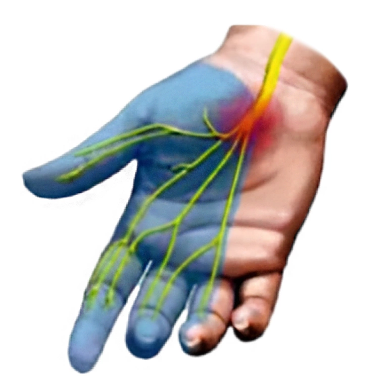 Повреждение нервов: лечение, симптомы и причины заболевания