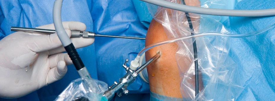 Артроскопия диагностическая и лечебная - цены, показания | Сделать ...